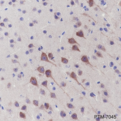 Anti-PYK2 Rabbit mAb