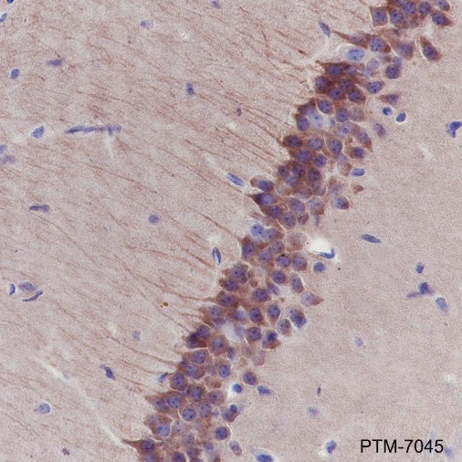 Anti-PYK2 Rabbit mAb