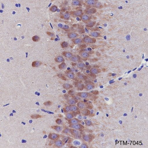 Anti-PYK2 Rabbit mAb