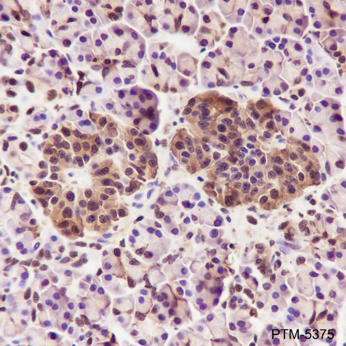 Anti-GAPDH Rabbit mAb