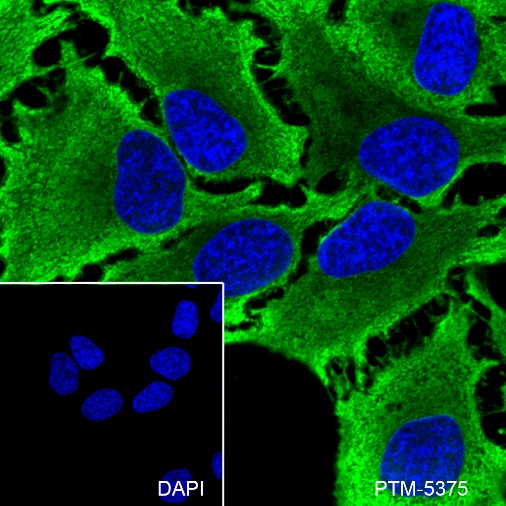 Anti-GAPDH Rabbit mAb