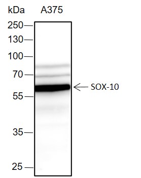 Anti-SOX10 Rabbit mAb