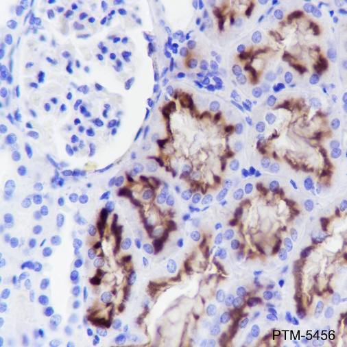 Anti-CD13 Rabbit mAb