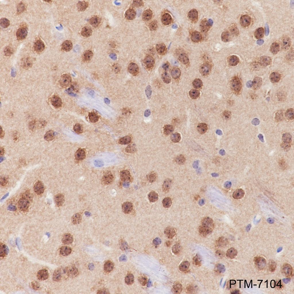 Anti-DARPP-32 Rabbit mAb