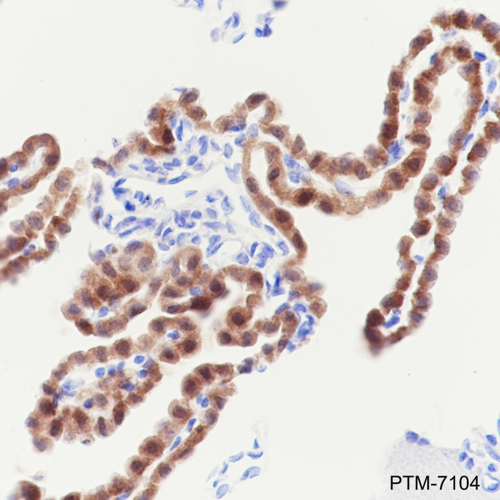 Anti-DARPP-32 Rabbit mAb