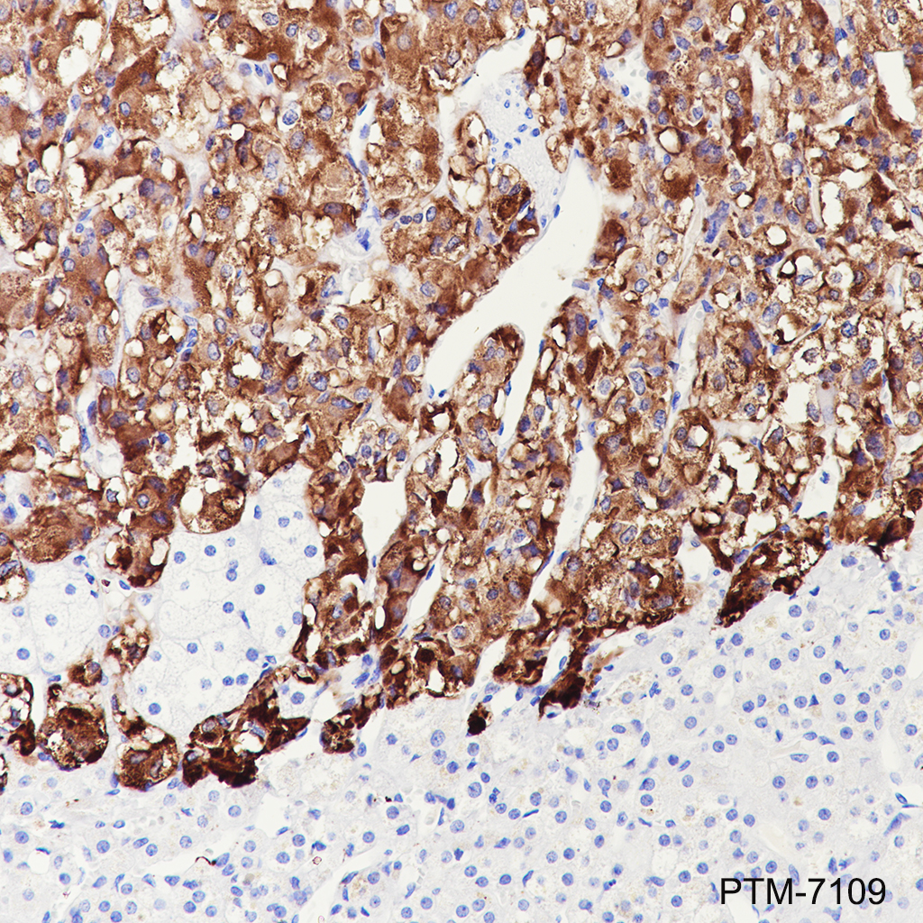 Anti-Dopamine beta Hydroxylase Rabbit mAb