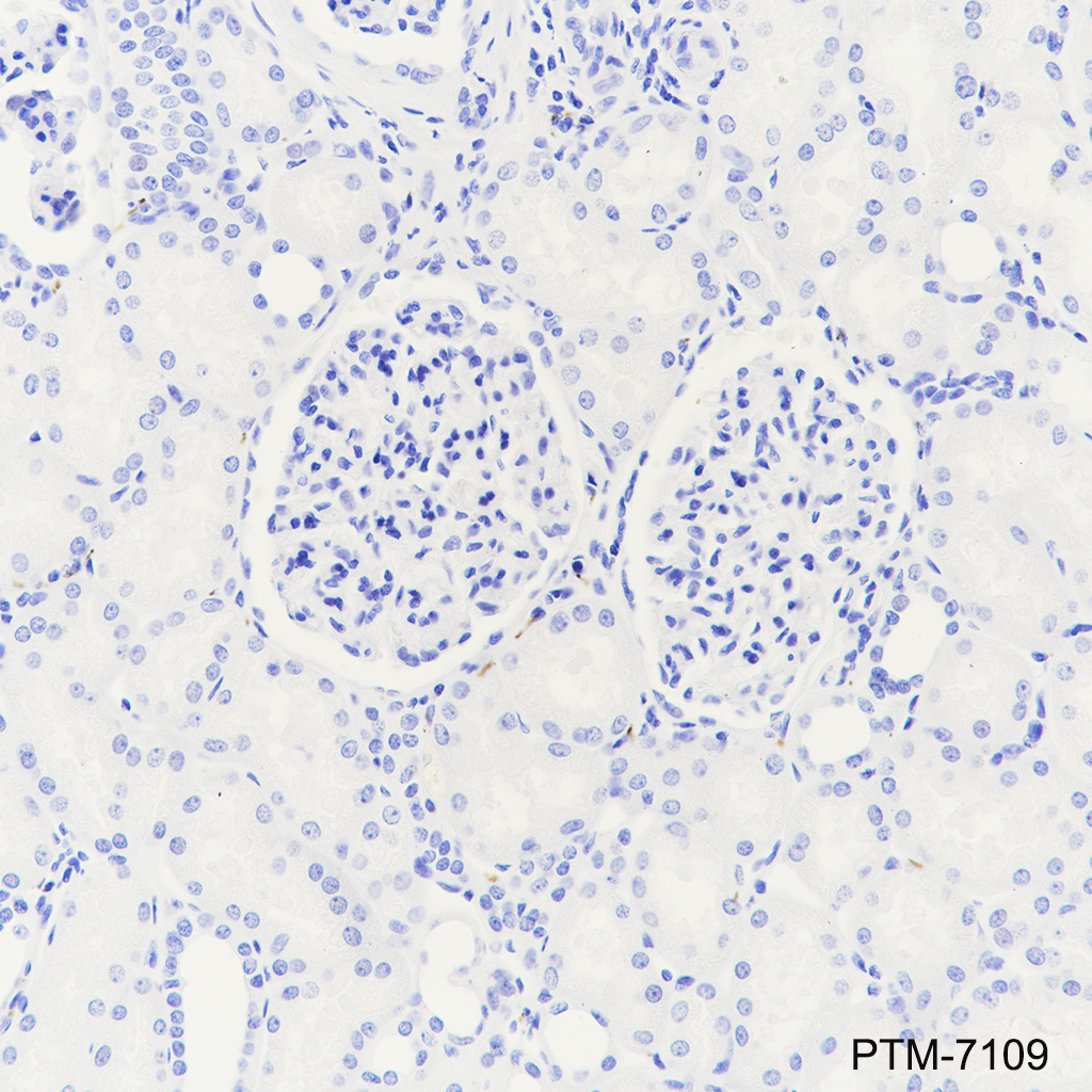 Anti-Dopamine beta Hydroxylase Rabbit mAb
