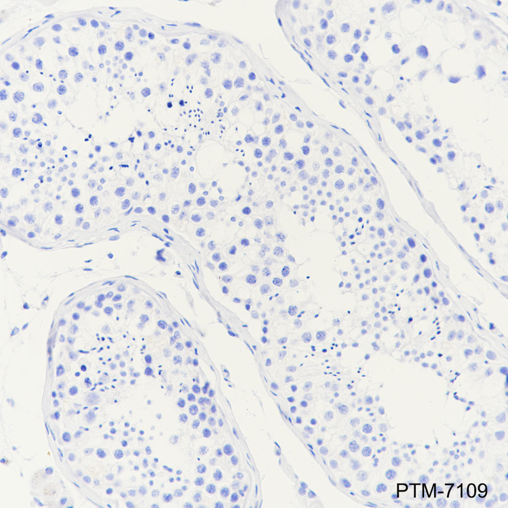 Anti-Dopamine beta Hydroxylase Rabbit mAb