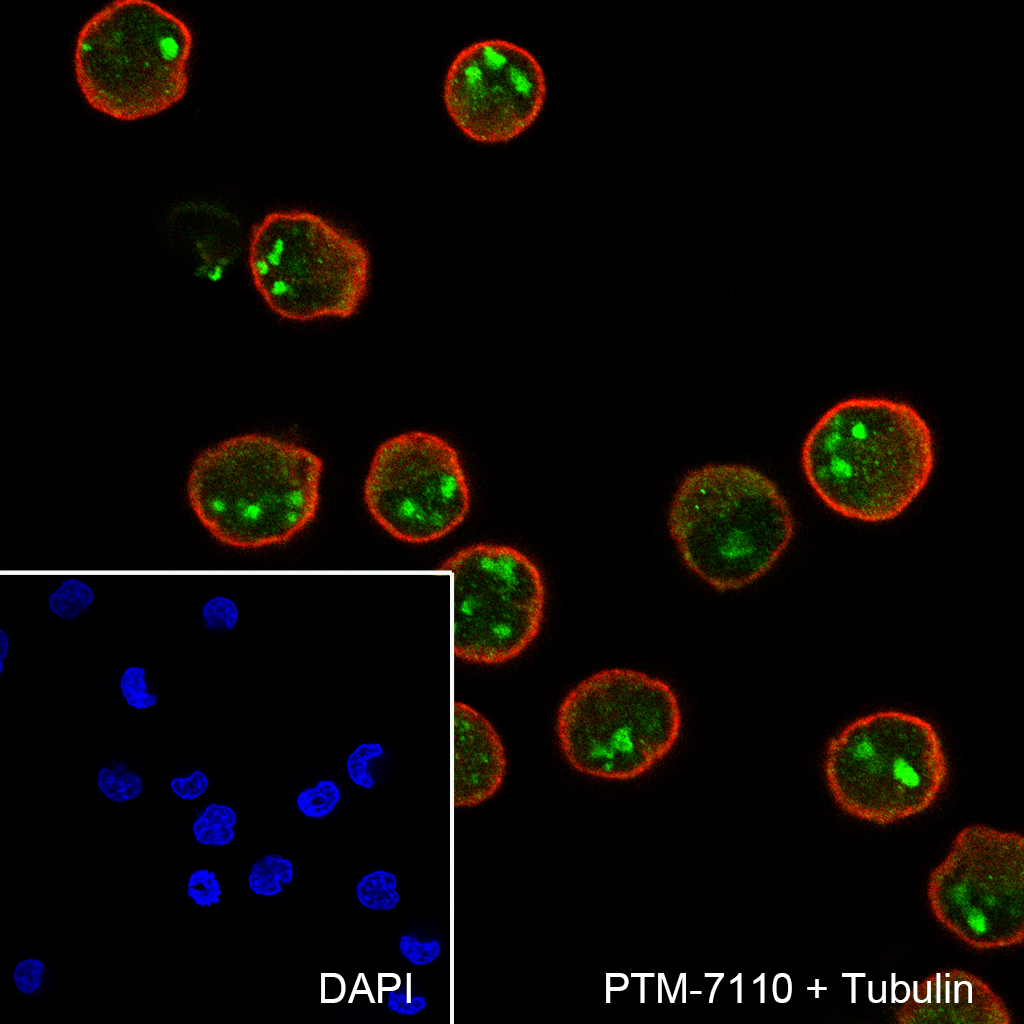 Anti-TOP3B Rabbit mAb