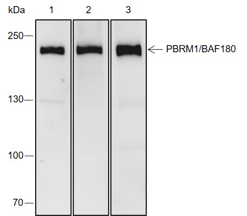 Anti-PBRM1/BAF180 Rabbit mAb