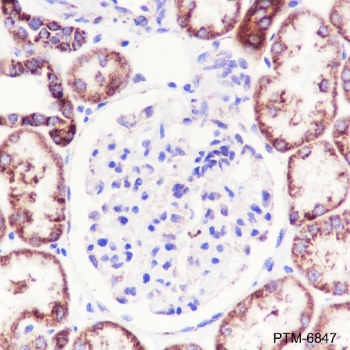 Anti-UQCRFS1/RISP Rabbit mAb