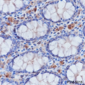 Anti-beta Actin Mouse mAb