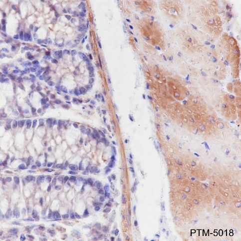 Anti-beta Actin Mouse mAb