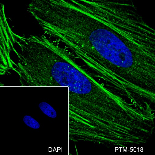 Anti-beta Actin Mouse mAb