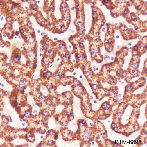 Anti-CPS1 Rabbit mAb