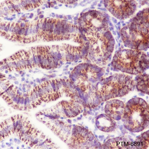 Anti-CPS1 Rabbit mAb