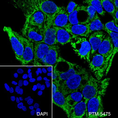 Anti-Mitofusin 1 Mouse mAb