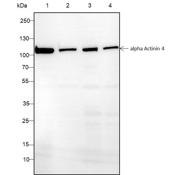 Anti-alpha Actinin 4 Rabbit mAb