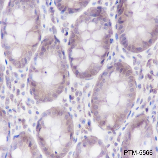 Anti-alpha Actinin 4 Rabbit mAb