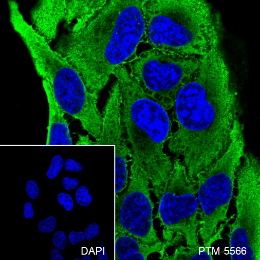 Anti-alpha Actinin 4 Rabbit mAb