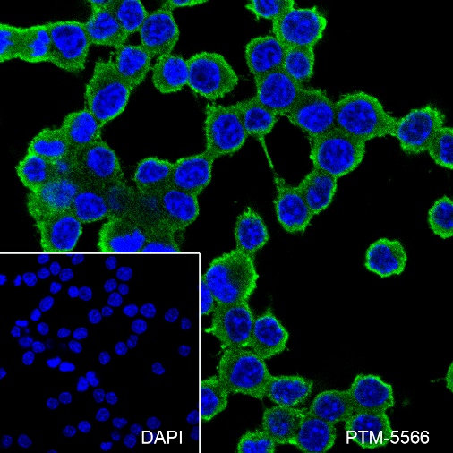 Anti-alpha Actinin 4 Rabbit mAb