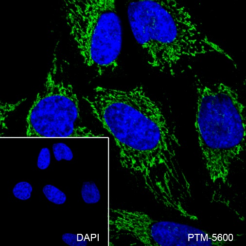 Anti-ATPB Mouse mAb