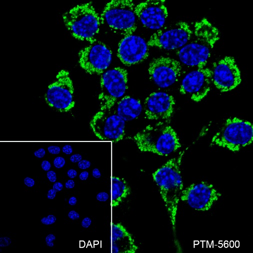 Anti-ATPB Mouse mAb