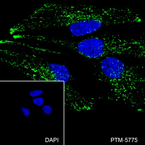 Anti-LAMP1 Mouse mAb