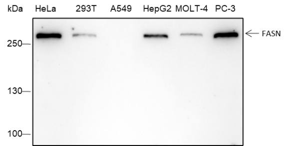 Anti-Fatty Acid Synthase Rabbit mAb