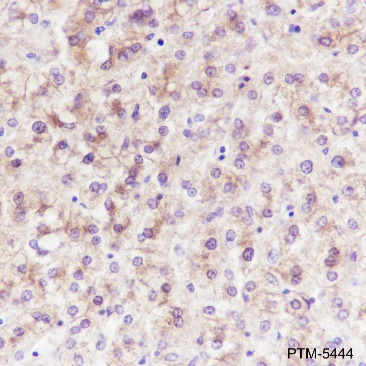 Anti-Fatty Acid Synthase Rabbit mAb
