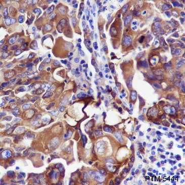 Anti-Fatty Acid Synthase Rabbit mAb