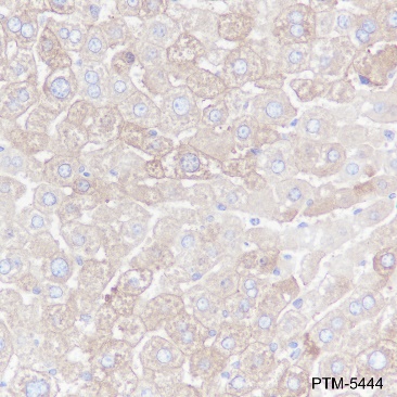 Anti-Fatty Acid Synthase Rabbit mAb