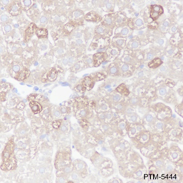 Anti-Fatty Acid Synthase Rabbit mAb
