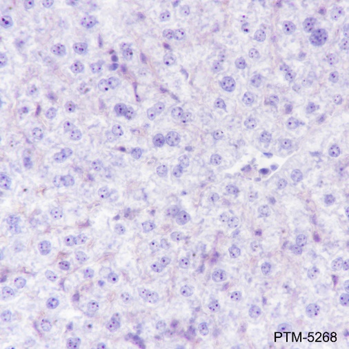 Anti-NPM1 Rabbit mAb