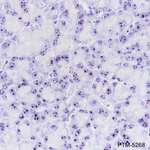 Anti-NPM1 Rabbit mAb