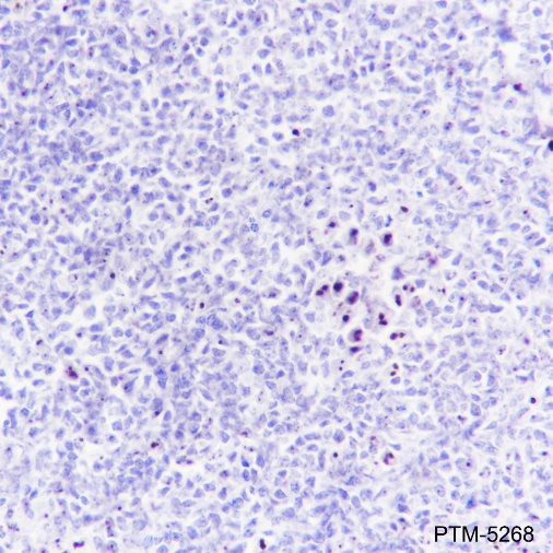 Anti-NPM1 Rabbit mAb