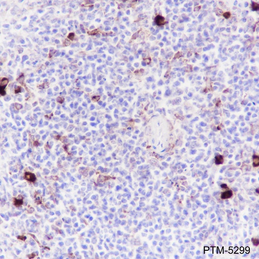 Anti-Phospho-S6 Ribosomal Protein (Ser240/244) Rabbit mAb