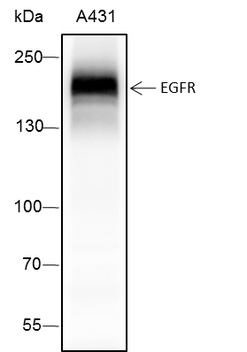Anti-EGFR Rabbit mAb