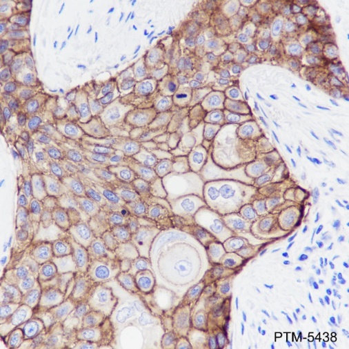 Anti-EGFR Rabbit mAb