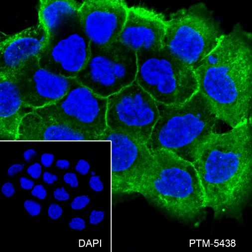 Anti-EGFR Rabbit mAb