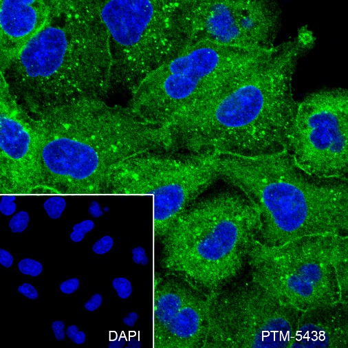 Anti-EGFR Rabbit mAb