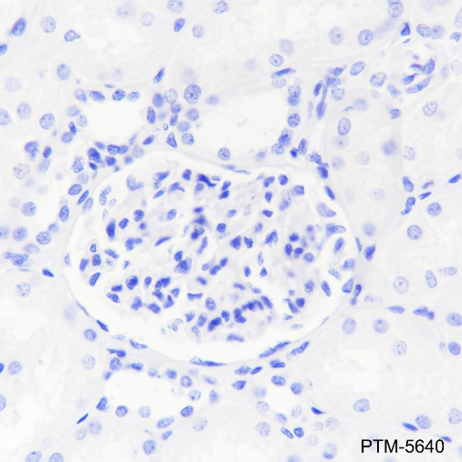 Anti-CD23 Rabbit mAb