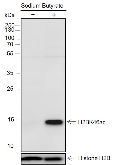 Anti-Acetyl-Histone H2B (Lys46) Rabbit pAb