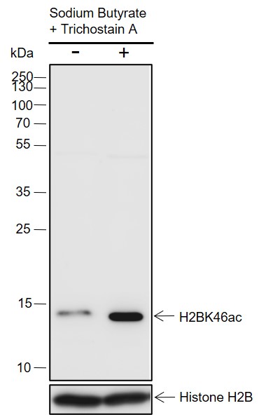 Anti-Acetyl-Histone H2B (Lys46) Rabbit pAb