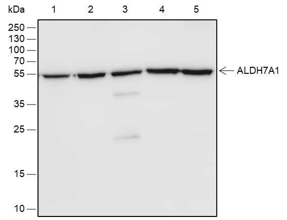 Anti-ALDH7A1 Rabbit mAb