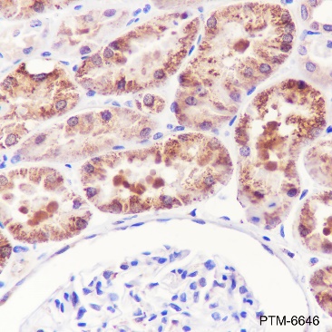 Anti-ALDH7A1 Rabbit mAb