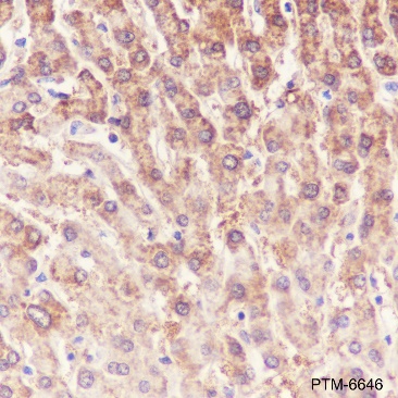 Anti-ALDH7A1 Rabbit mAb