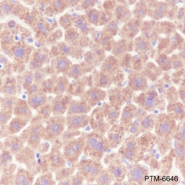 Anti-ALDH7A1 Rabbit mAb