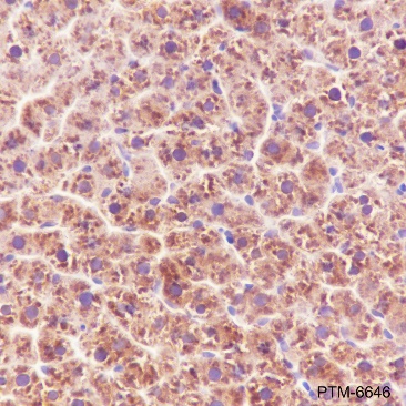Anti-ALDH7A1 Rabbit mAb