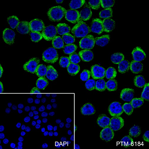 Anti-KRAS Rabbit mAb